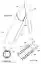 Fig. 21 - INTRAVENOUS (IV) TRAINING SYSTEM