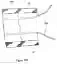 Fig. 23 - INTRAVENOUS (IV) TRAINING SYSTEM