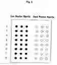 Fig. 03 - Dna Array and Method for Detecting Single Nucleotide Polymorphism