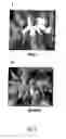 Fig. 06 - Disarmed strains, Ri-plasmids, and methods of transformation based thereon