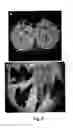 Fig. 08 - Disarmed strains, Ri-plasmids, and methods of transformation based thereon