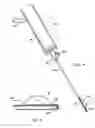 Fig. 06 - Apparatuses and Methods for Interstitial Tissue Removal