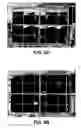 Fig. 07 - Apparatuses and Methods for Interstitial Tissue Removal