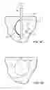 Fig. 08 - Apparatuses and Methods for Interstitial Tissue Removal