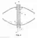 Fig. 06 - Occlusion device with flexible fabric connector