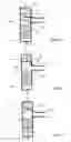 Fig. 03 - Particle filter regeneration method with catalytic combustion device and filtration installation using such a method