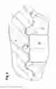 Fig. 05 - Continuously variable transmission