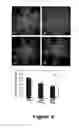 Fig. 06 - Compounds useful in treating diabetic microvascular complications and age-related macular degeneration