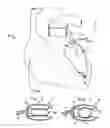 Fig. 02 - Devices and methods for absorbing, transferring, and delivering heart energy