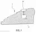 Fig. 02 - Foot sole massager