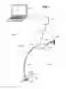 Fig. 02 - Endoscopic device delivery system