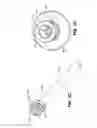 Fig. 07 - Endoscopic device delivery system