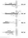 Fig. 08 - Endoscopic device delivery system