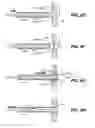 Fig. 09 - Endoscopic device delivery system