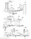 Fig. 06 - Implant capable of forming a differential image in an eye and methods of inserting and locating same