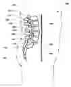 Fig. 01 - Orthopedic implant with integrated bone screw