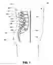 Fig. 02 - Orthopedic implant with integrated bone screw