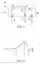 Fig. 03 - PERCUTANEOUS SPINAL IMPLANTS AND METHODS