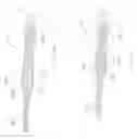 Fig. 10 - PERCUTANEOUS SPINAL IMPLANTS AND METHODS