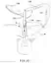 Fig. 23 - PERCUTANEOUS SPINAL IMPLANTS AND METHODS