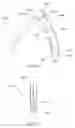 Fig. 24 - PERCUTANEOUS SPINAL IMPLANTS AND METHODS