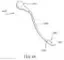 Fig. 27 - PERCUTANEOUS SPINAL IMPLANTS AND METHODS