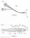 Fig. 72 - PERCUTANEOUS SPINAL IMPLANTS AND METHODS