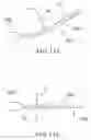 Fig. 76 - PERCUTANEOUS SPINAL IMPLANTS AND METHODS