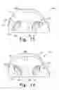 Fig. 09 - Tibial insert having a reinforced keel