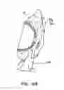 Fig. 09 - Modular orthopaedic implant apparatus