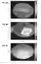 Fig. 07 - ULTRASOUND ACCELERATED TISSUE ENGINEERING PROCESS