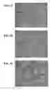 Fig. 08 - ULTRASOUND ACCELERATED TISSUE ENGINEERING PROCESS