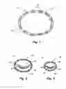Fig. 02 - Implantable devices for controlling the internal circumference of an anatomic orifice or lumen