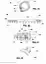 Fig. 09 - Implantable devices for controlling the internal circumference of an anatomic orifice or lumen