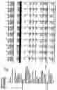 Fig. 67 - Duty and tax avoidance device and system