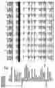 Fig. 76 - Duty and tax avoidance device and system