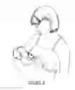 Fig. 04 - Nursing garment
