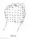 Fig. 11 - Glove