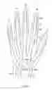 Fig. 12 - Glove