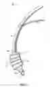 Fig. 02 - Endotracheal cuff and technique for using the same