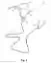Fig. 02 - SUSPENSION RELIEF DEVICE AND METHOD OF USE THEREOF