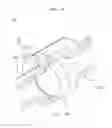 Fig. 07 - Coupling and decoupling assembly of pipe having double valve