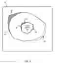 Fig. 04 - Treatment delivery optimization