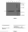Fig. 02 - Gram positive bacterial cells comprising a disrupted flagellin gene, flagellin-based fusion proteins and use in removal of metal ions from a liquid