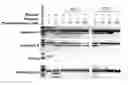 Fig. 01 - Method for identifying HIV-1 protease inhibitors with reduced metabolic affects through detection of human resistin polymorphisms