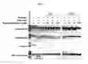Fig. 03 - Method for identifying HIV-1 protease inhibitors with reduced metabolic affects through detection of human resistin polymorphisms