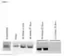 Fig. 15 - Retinal dystrophy-associated protein and uses thereof
