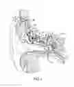 Fig. 02 - COMPRESSIVE COUPLING OF AN IMPLANTABLE HEARING AID ACTUATOR TO AN AUDITORY COMPONENT