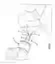 Fig. 07 - COMPRESSIVE COUPLING OF AN IMPLANTABLE HEARING AID ACTUATOR TO AN AUDITORY COMPONENT