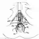 Fig. 01 - Method of treating anal incontinence